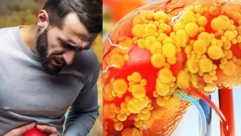 Liver Cirrhosis Symptoms: ਲੀਵਰ ਸਿਰੋਸਿਸ ਹੋਣ ‘ਤੇ ਦਿਸਦੇ ਹਨ ਇਹ ਲੱਛਣ ? ਜੇ ਮਹਿਸੂਸ ਹੋਵੇ ਇਹ ਪਰੇਸ਼ਾਨੀ ਤਾਂ ਅੱਜ ਹੀ ਹੋ ਜਾਓ ਸਾਵਧਾਨ