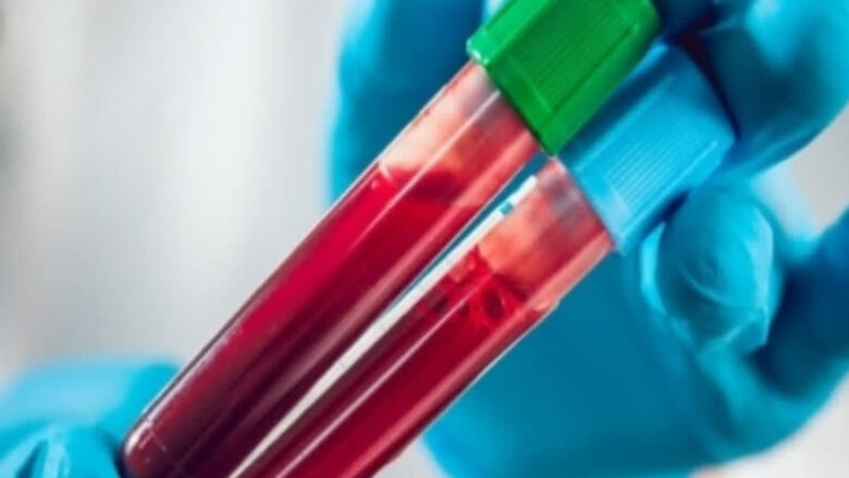 ਵਿਆਹ ਤੋਂ ਪਹਿਲਾ ਮਰਦਾਂ ਨੂੰ ਕਰਵਾਉਣਾ ਹੋਵੇਗਾ ਇਹ ਟੈਸਟ? ਸੰਸਦ ਵਿੱਚ ਉੱਠੀ ਮੰਗ, ਜਾਣੋ